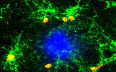 microglial cells (green)